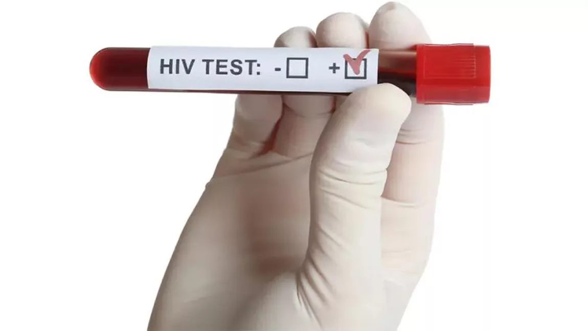 HIV simptome bărbați. Cum se manifestă infectarea