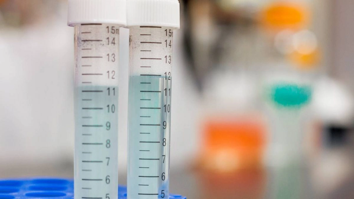 coronavirus teste