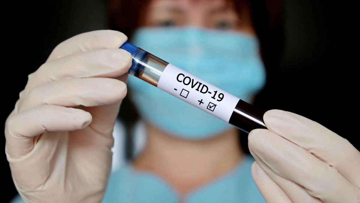 test covid-19