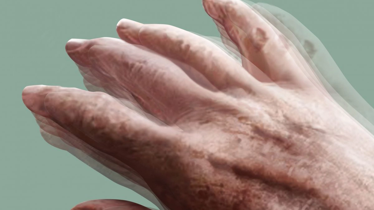 mana-tremuranda-parkinson