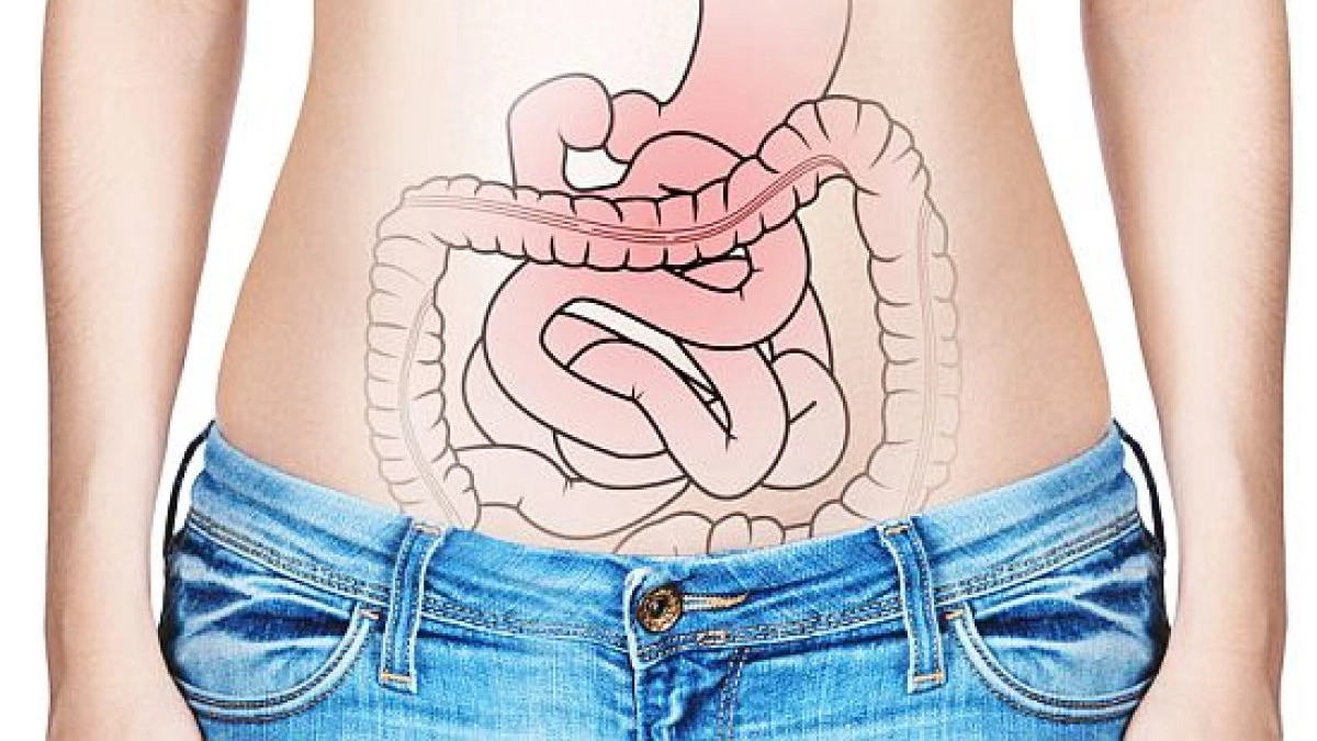sindromul-intestinului-iritabil-simptome-cauze