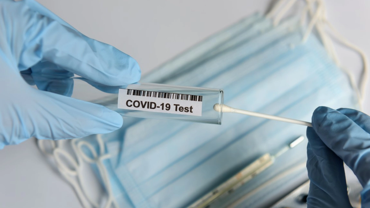 test-covid-19