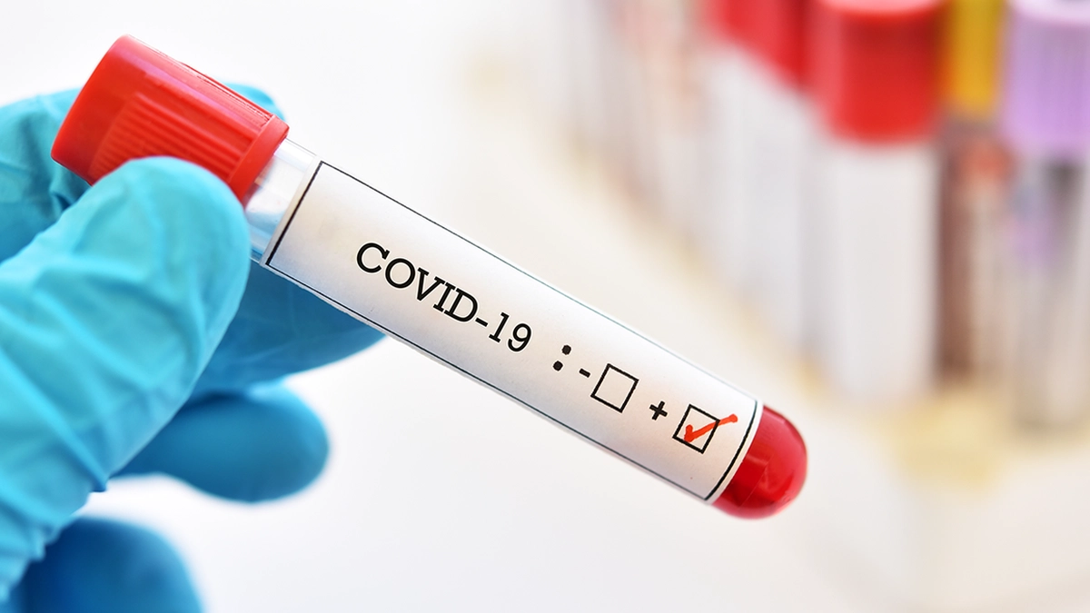 test-covid