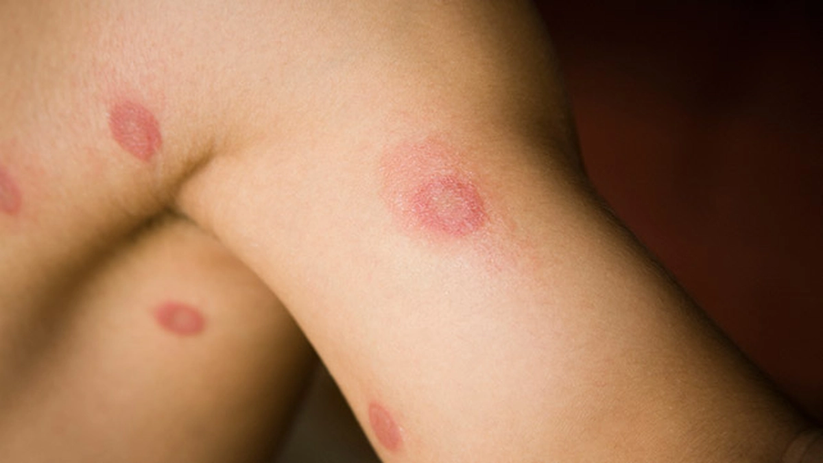 infectie-in-sange