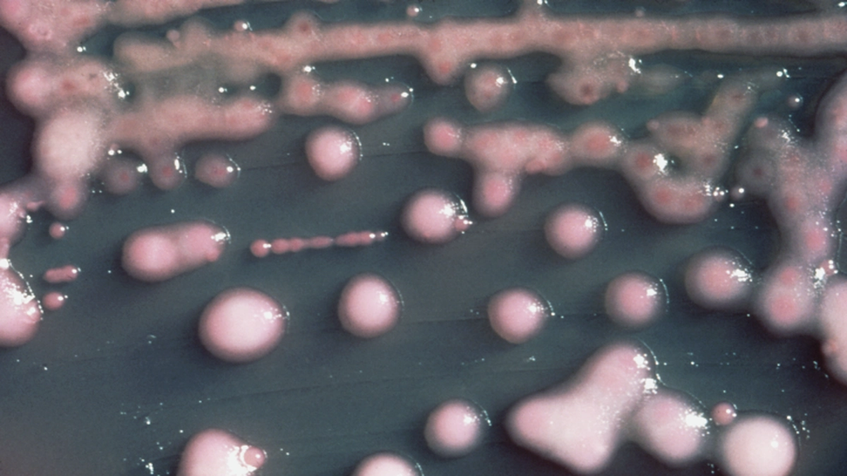 Klebsiella_pneumoniae.png