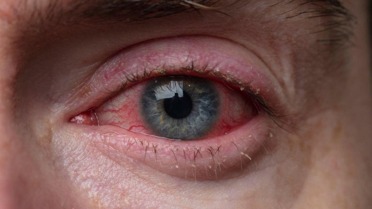 tratament tras curent ochi restabilirea vederii subconștiente