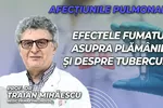 Prof. dr. Traian Mihăescu medic primar pneumolog discută în emisiunea de sănătate BZI LIVE despre afecțiunile pulmonare despre efectele fumatului asupra plămânilor și despre tuberculoză