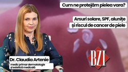 LIVE VIDEO – Sănătatea pielii vara, arsuri solare, alunițe periculoase și protecția corectă cu SPF, subiectul emisiunii de sănătate BZI LIVE, împreună cu invitata dr. Claudia Artenie, medic primar dermatologie și estetică medicală