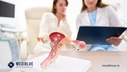Cancerul de col uterin, tot mai prezent în România