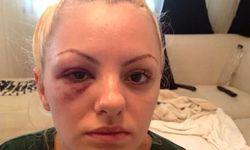 Термическая обработка металлов отжиг. Рекристаллизационный отжиг. После стан. Дефект выкрашивание металла. Рельсовая сталь термообработка.