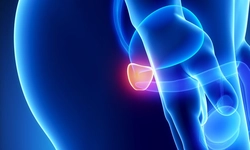Este posibil să se vindece prostatita - Hipoglicemie