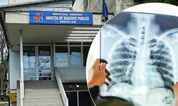 Screening gratuit pentru depistarea tuberculozei în județul Iași Se dorește testarea a 3.000 de persoane cu risc ridicat de îmbolnăvire