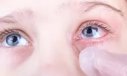 Secreție galbenă la ochi copii. Afecțiunile care provoacă manifestarea acestui disconfort