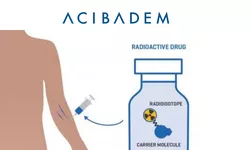 Top radiofarmaceutice folosite de experții Acibadem în depistarea și tratarea cancerului 8211 VIDEO