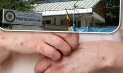 Administrația Națională a Penitenciarelor confirmă dezastrul din Penitenciarul Iași Oficial mai mulți deținuți s-au umplut de scabie Au fost raportate șase cazuri 8211 FOTO