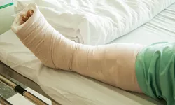 Caz șocant la Spitalul din Slobozia Un pacient cu piciorul rupt a trebuit să aștepte 10 zile să fie operat