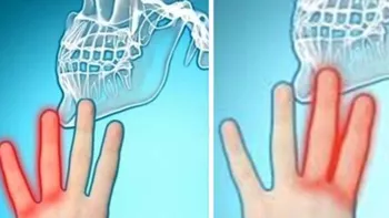 5 boli periculoase ce au ca simptome amorțirea mâinilor sau picioarelor