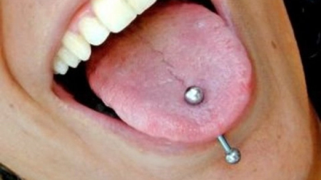 I s-a umflat toata limba dupa ce si-a facut piercing