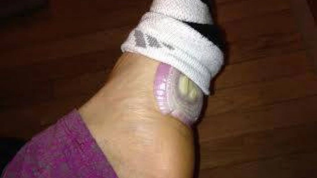 De ce ar trebui să-ti pui ceapa în șosete