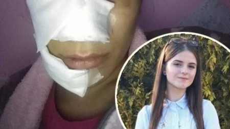 Una dintre româncele care a vrut să o salveze pe Alexandra a fost desfigurată