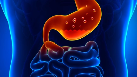 Semnele si cauzele cancerului de stomac