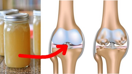 Chiar şi medicii au rămas surprinşi: Iată reţetă care ajută la refacerea articulaţiilor în 14 zile!