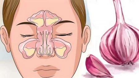 Trucul care iti desfunda nasul. Asa scapi de raceala in 24 de ore