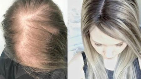 Cea mai puternică rețetă naturistă pentru creșterea și regenerarea părului