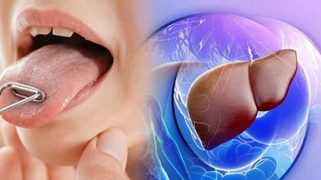 Cum verifici cât de sănătos e ficatul tău