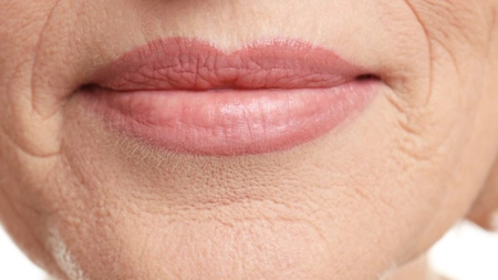 Remediile bunicii pentru ridurile din jurul gurii
