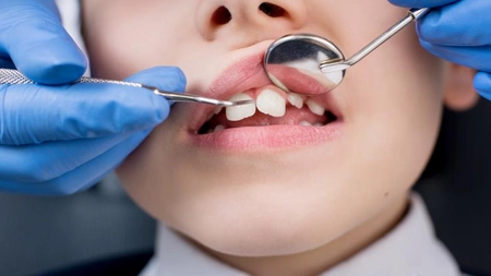 Rezultate autopsiei copilului, în vârstă de patru ani, decedat după o anestezie la dentist