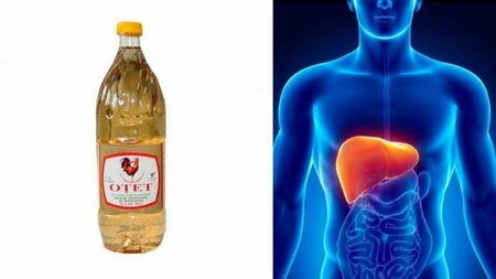 Aşa îţi vindeci ficatul de boli cu oţetul din bucătărie! Reţeta veche care chiar funcţionează