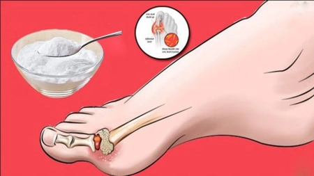 Cele mai recomandate alimente împotriva gutei