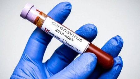 Cercetătorii au ajuns la o concluzie! Coronavirus este asemănător cu HIV