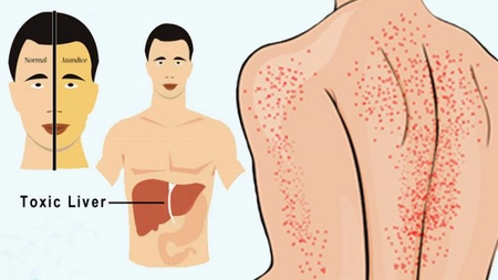 Cu ce alimente îţi cureţi ficatul de toxine