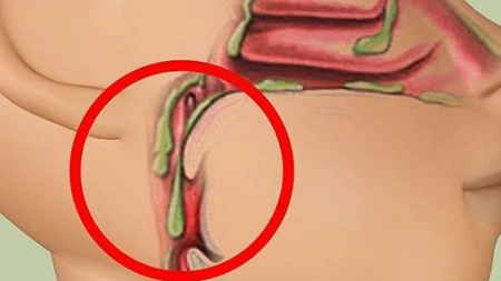 Ce alimente să consumi ca să elimini mucusul