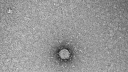 Prima imagine la microscop cu noul coronavirus. Ruşii transmit că ar putea ajuta la găsirea unui vaccin - FOTO