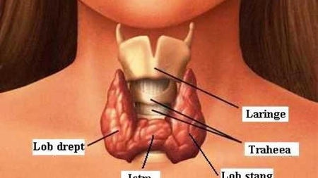 Cele mai eficiente alimente împotriva hipertiroidiei