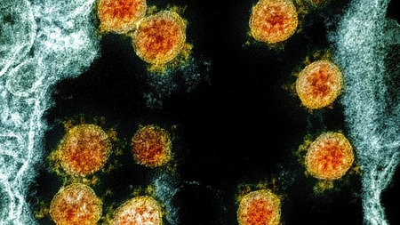 Contestatarii coronavirus, cenzurați de CNA: Presa, somată să nu difuzeze informații care nu sunt din surse oficiale!