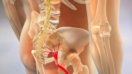 Sciatica: 7 sfaturi de la un reumatolog