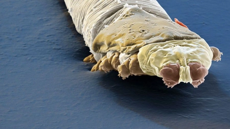 Uleiul de arbore de ceai ucide acarienii Demodex, care ne populeaza fata