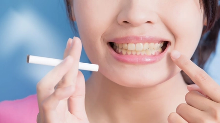 Recomandările specialiștilor în stomatologie: fumatul și implantul dentar