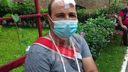 Bătut și furat de un consătean, care apoi l-a și postat pe Facebook. A ajuns la IML în stare deplorabilă