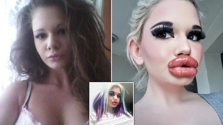 Transformare uluitoare a unei femei după mai multe operaţii estetice