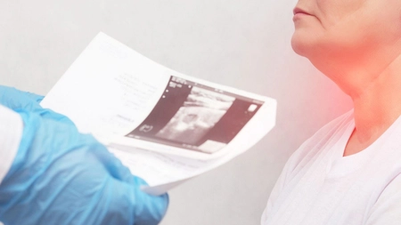 Cancerul tiroidian: care sunt primele simptome?
