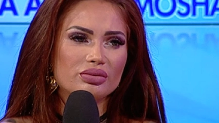 Maria Ilioiu, mutilată în urma unor tratamente cosmetice. Cum arata acum