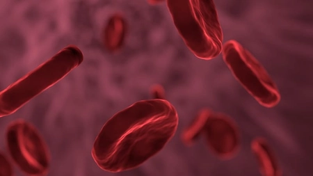 Cancer limfatic - Cauză și simptome. Se poate preveni?