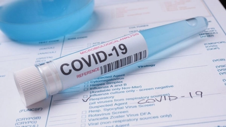 Covid-19: Oamenii de știință testează un tratament pentru a preveni infecția imediat după expunere