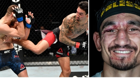 Un sportiv a încasat 445 de lovituri, câte una la fiecare 3 secunde. Cum arată acesta - FOTO