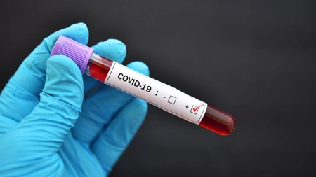 Un potențial medicament pentru COVID-19 are succes în studiile de laborator